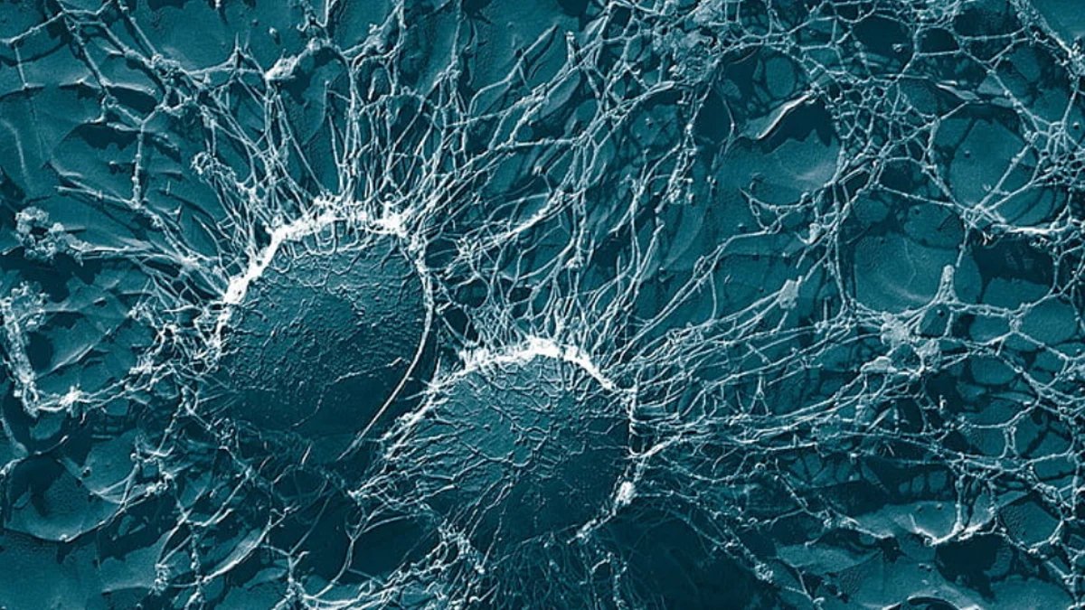 Una bacteria submarina efectiva contra el cáncer